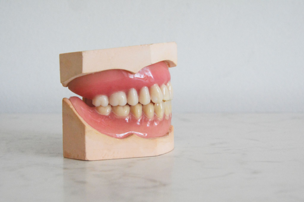 a model of teeth used by dentist 