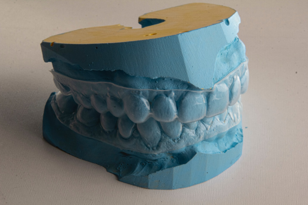 Invisalign aligners on teethpng
