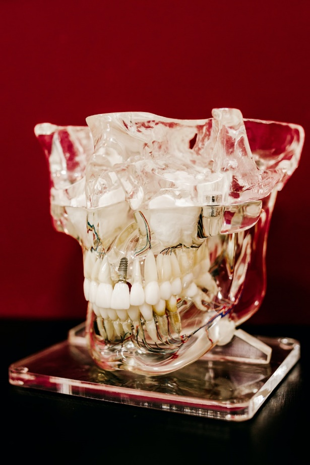a model of the human jaw