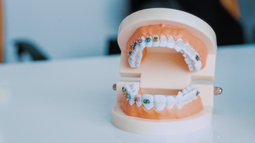 metal braces on a denture