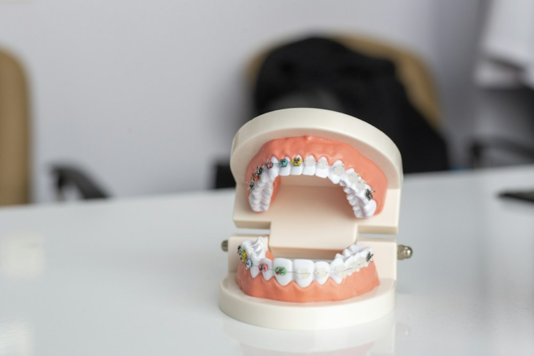 Braces on a teeth model